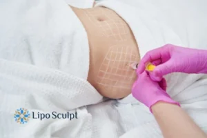 Are The Results From Aqualyx Permanent? 1 Do you want to know how long Aqualyx Lancaster results last?
